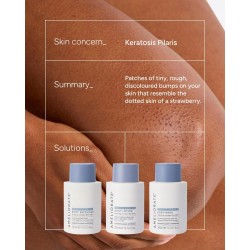 AMELIORATE Nawilżający Balsam do Ciała 300ml na Keratozę Pilaris